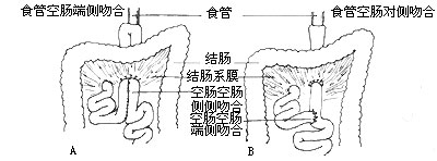 賁門癌