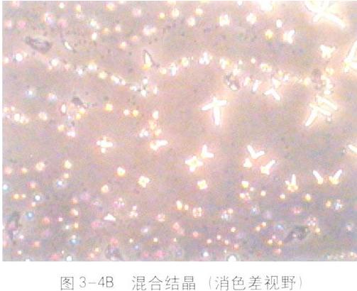 miꎵDV——miճҺ}YcϽY